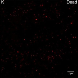 Invitrogen Goat anti-Rabbit IgG (H+L) Cross-Adsorbed Secondary Antibody,