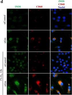 Invitrogen Donkey anti-Rabbit IgG (H+L) Highly Cross-Adsorbed Secondary