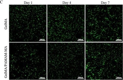 Invitrogen Donkey anti-Rabbit IgG (H+L) Highly Cross-Adsorbed Secondary
