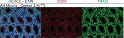 Invitrogen Donkey anti-Rat IgG (H+L) Highly Cross-Adsorbed Secondary Antibody,