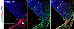 Invitrogen Chicken anti-Rabbit IgG (H+L) Cross-Adsorbed Secondary Antibody,