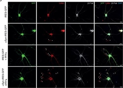 Invitrogen Donkey anti-Rabbit IgG (H+L) Highly Cross-Adsorbed Secondary