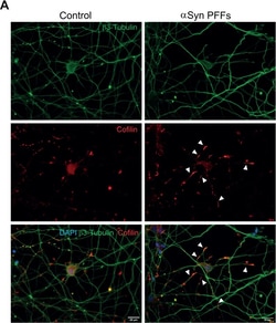 Invitrogen Donkey anti-Rabbit IgG (H+L) Highly Cross-Adsorbed Secondary