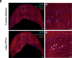 Invitrogen Donkey anti-Rabbit IgG (H+L) Highly Cross-Adsorbed Secondary