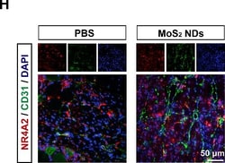 Invitrogen Goat anti-Rabbit IgG (H+L) Cross-Adsorbed Secondary Antibody,