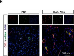 Invitrogen Goat anti-Rabbit IgG (H+L) Cross-Adsorbed Secondary Antibody,