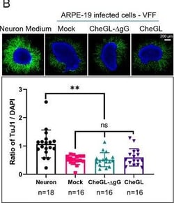 Invitrogen Goat anti-Mouse IgG (H+L) Highly Cross-Adsorbed Secondary Antibody,