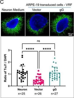 Invitrogen Goat anti-Mouse IgG (H+L) Highly Cross-Adsorbed Secondary Antibody,