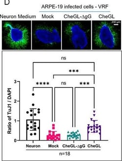 Invitrogen Goat anti-Mouse IgG (H+L) Highly Cross-Adsorbed Secondary Antibody,
