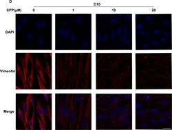 Invitrogen Goat anti-Rabbit IgG (H+L) Highly Cross-Adsorbed Secondary Antibody,