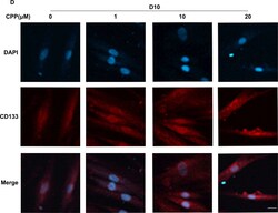 Invitrogen Goat anti-Rabbit IgG (H+L) Highly Cross-Adsorbed Secondary Antibody,