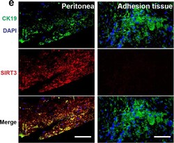 Invitrogen Goat anti-Rabbit IgG (H+L) Cross-Adsorbed Secondary Antibody,