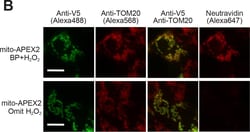 Invitrogen Goat anti-Mouse IgG (H+L) Highly Cross-Adsorbed Secondary Antibody,
