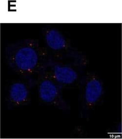Invitrogen Goat anti-Rabbit IgG (H+L) Cross-Adsorbed Secondary Antibody,