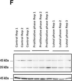 Invitrogen Goat anti-Rabbit IgG (H+L) Cross-Adsorbed Secondary Antibody,