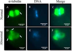 Invitrogen Goat anti-Mouse IgG (H+L) Highly Cross-Adsorbed Secondary Antibody,