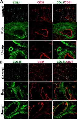 Invitrogen Donkey anti-Mouse IgG (H+L) Highly Cross-Adsorbed Secondary