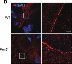 Invitrogen Donkey anti-Mouse IgG (H+L) Highly Cross-Adsorbed Secondary