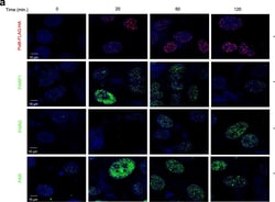 Invitrogen&trade;&nbsp;Rabbit anti-Mouse IgG (H+L) Cross-Adsorbed Secondary Antibody, Alexa Fluor&trade; 594