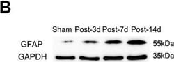 Invitrogen Goat anti-Mouse IgG (H+L) Secondary Antibody, HRP 2 mL; HRP:Antibodies,