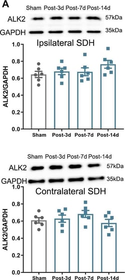 Invitrogen Goat anti-Rabbit IgG (H+L) Secondary Antibody, HRP 2 mL; HRP:Antibodies,