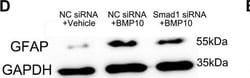 Invitrogen Goat anti-Mouse IgG (H+L) Secondary Antibody, HRP 2 mL; HRP:Antibodies,