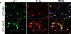 Invitrogen Goat anti-Rabbit IgG (H+L) Cross-Adsorbed Secondary Antibody,