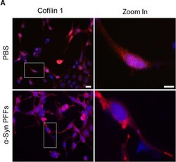 Invitrogen Goat anti-Rabbit IgG (H+L) Cross-Adsorbed Secondary Antibody,