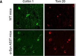 Invitrogen Goat anti-Rabbit IgG (H+L) Cross-Adsorbed Secondary Antibody,