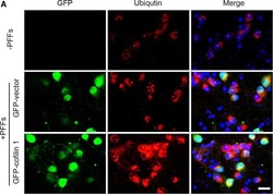 Invitrogen™ Goat anti-Rabbit IgG (H+L) Cross-Adsorbed Secondary Antibody, Alexa Fluor™ 594