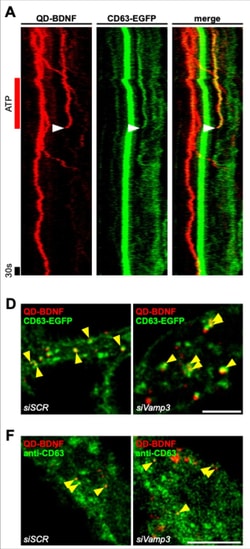 Invitrogen Goat anti-Mouse IgG (H+L) Highly Cross-Adsorbed Secondary Antibody,