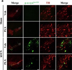 Invitrogen Goat anti-Mouse IgG (H+L) Highly Cross-Adsorbed Secondary Antibody,
