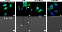 Invitrogen Donkey anti-Rabbit IgG (H+L) Highly Cross-Adsorbed Secondary