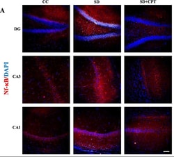 Invitrogen Goat anti-Rabbit IgG (H+L) Highly Cross-Adsorbed Secondary Antibody,