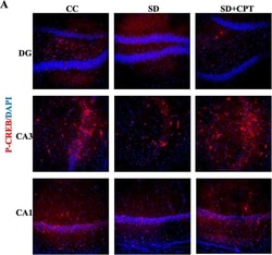 Invitrogen Goat anti-Rabbit IgG (H+L) Highly Cross-Adsorbed Secondary Antibody,