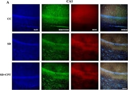 Invitrogen Goat anti-Rabbit IgG (H+L) Highly Cross-Adsorbed Secondary Antibody,