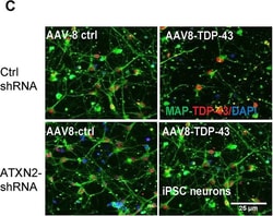 Invitrogen Goat anti-Rabbit IgG (H+L) Highly Cross-Adsorbed Secondary Antibody,