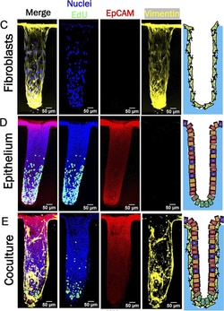 Invitrogen Donkey anti-Rabbit IgG (H+L) Highly Cross-Adsorbed Secondary