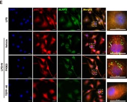 Invitrogen Donkey anti-Rabbit IgG (H+L) Highly Cross-Adsorbed Secondary