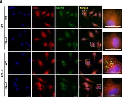 Invitrogen Donkey anti-Rabbit IgG (H+L) Highly Cross-Adsorbed Secondary