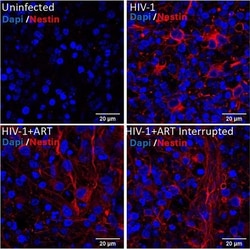Invitrogen Goat anti-Mouse IgG (H+L) Cross-Adsorbed Secondary Antibody,