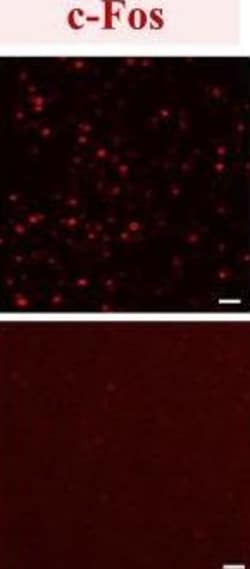 Invitrogen Donkey anti-Rabbit IgG (H+L) Highly Cross-Adsorbed Secondary