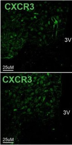 Invitrogen Donkey anti-Rabbit IgG (H+L) Highly Cross-Adsorbed Secondary