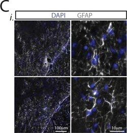 Invitrogen Goat anti-Rabbit IgG (H+L) Cross-Adsorbed Secondary Antibody,