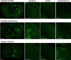 Invitrogen Donkey anti-Rabbit IgG (H+L) Highly Cross-Adsorbed Secondary