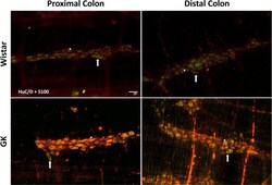 Invitrogen Donkey anti-Mouse IgG (H+L) Highly Cross-Adsorbed Secondary