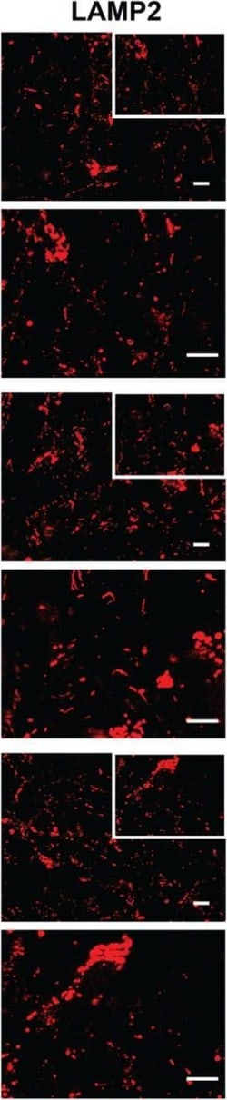 Invitrogen Goat anti-Mouse IgG (H+L) Cross-Adsorbed Secondary Antibody,