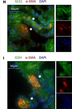 Invitrogen Donkey anti-Mouse IgG (H+L) Highly Cross-Adsorbed Secondary