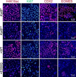 Invitrogen Donkey anti-Rabbit IgG (H+L) Highly Cross-Adsorbed Secondary