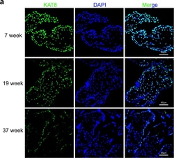 Invitrogen Donkey anti-Rabbit IgG (H+L) Highly Cross-Adsorbed Secondary